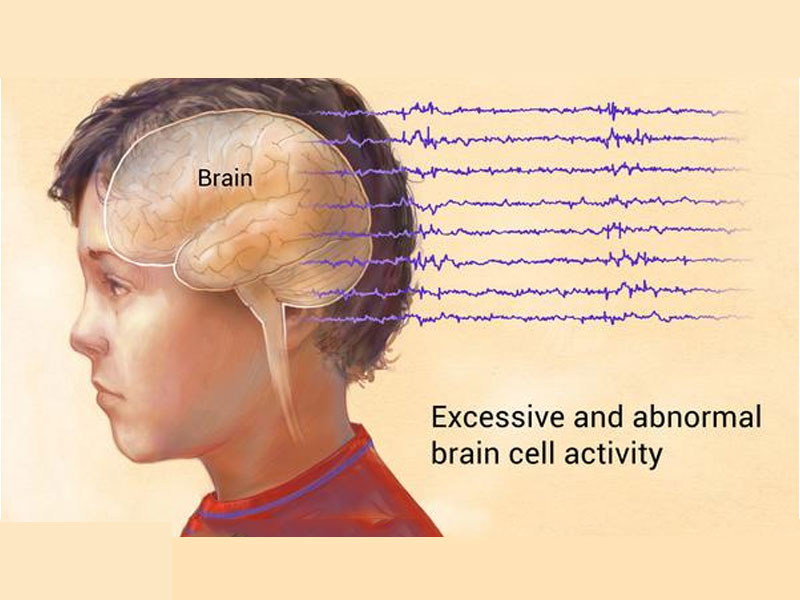 Electrophysiology Diagnostics